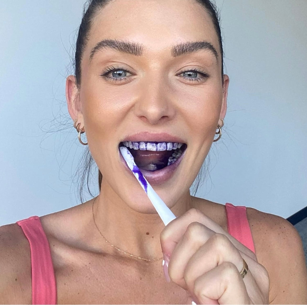 Teeth Whitening Smile Kit