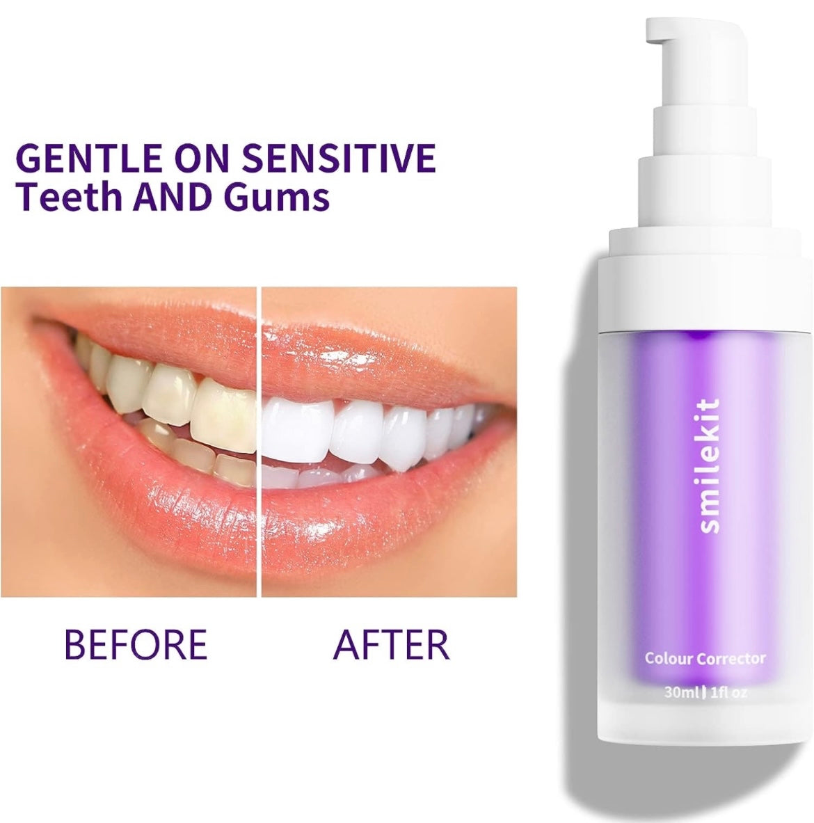 Teeth Whitening Smile Kit